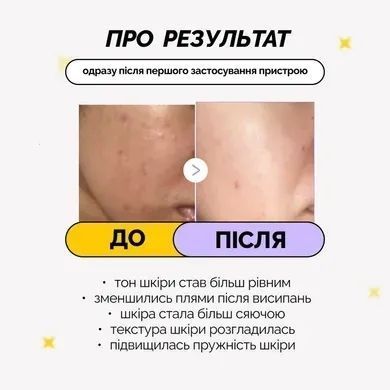 Міні-пристрій для домашнього догляду за шкірою Medicube AGE-R Booster Pro Mini krk_1464280171 фото