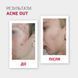 Матуючий тонік ACNE OUT / Для жирної шкіри та при легких формах акне 60 мл  biotr_982996 фото 3