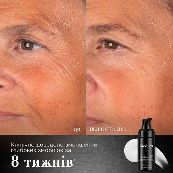 Liquid Peptides Advanced MPЛіквід пептайдс Адвансд ЕмПі - сироватка з проривною біотехнологією Dual MiniProteinsTM у складі для боротьби з ознаками старіння шкіри. med_645833 фото