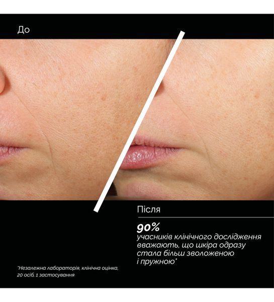 SKIN REGIMEN LX HA4 JELLY SERUM - ЗВОЛОЖУВАЛЬНИЙ КОНЦЕНТРАТ-СИРОВАТКА comfo_121757 фото