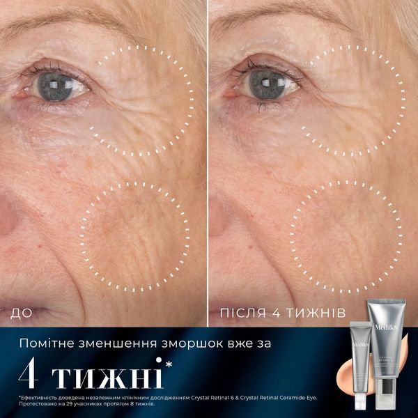 Retinal RewindНабір для омолодження шкіри обличчя та зони навколо очей med_215099 фото